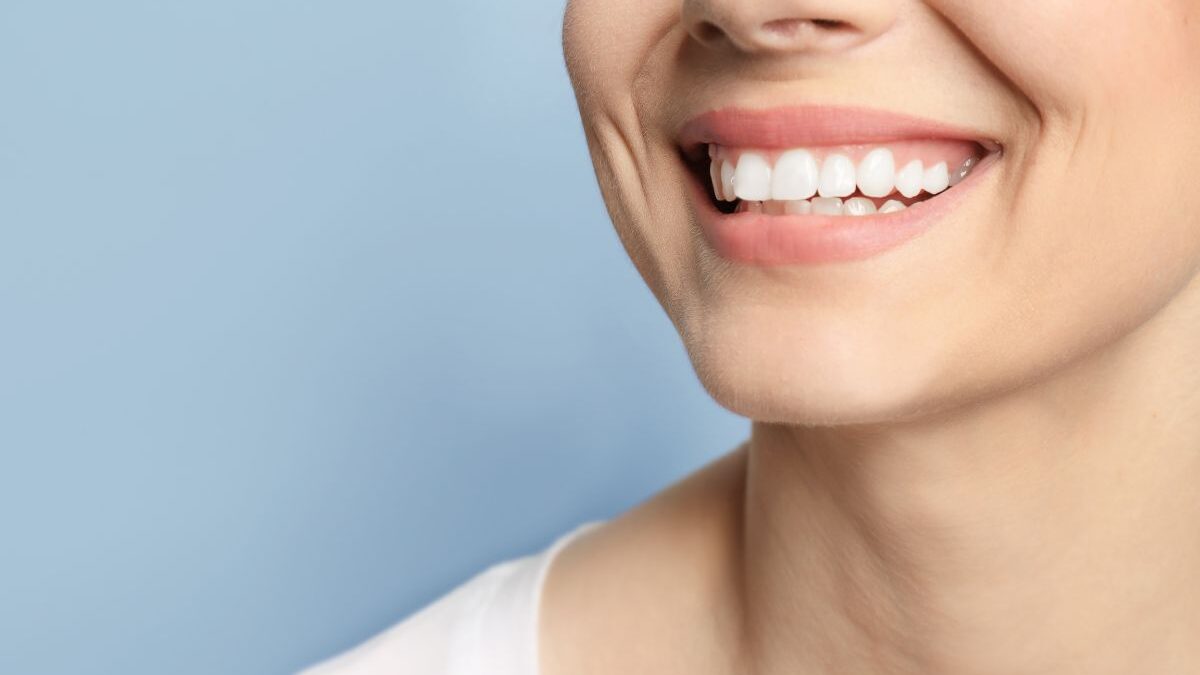 How Long Do Dental Implants Last? Are They Permanent?