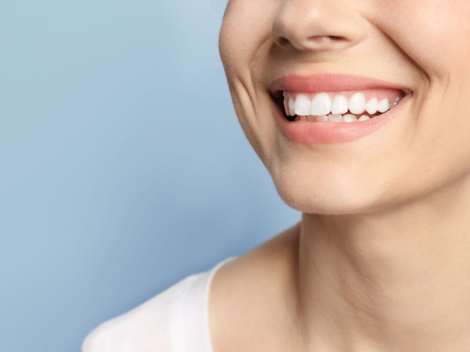 How Long Do Dental Implants Last? Are They Permanent?