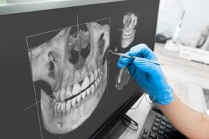 Dental Trends of 2024, what's coming?