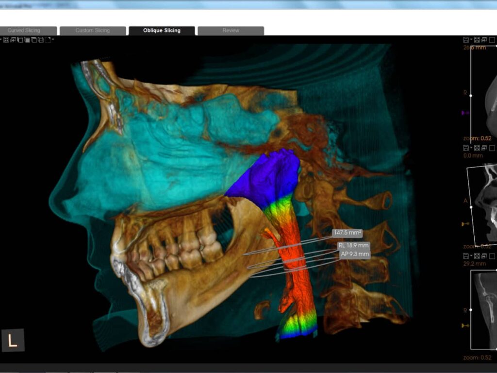 Airway Dentistry: A Holistic Approach to Whole-Body Health 2 Airway Dentistry: A Holistic Approach to Whole-Body Health