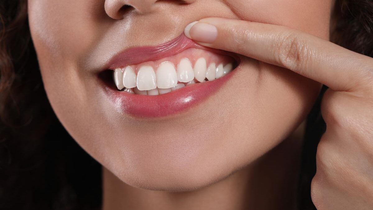 7 Ways to Keep Your Gums Healthy