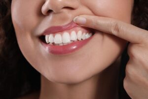 7 Ways to Keep Your Gums Healthy