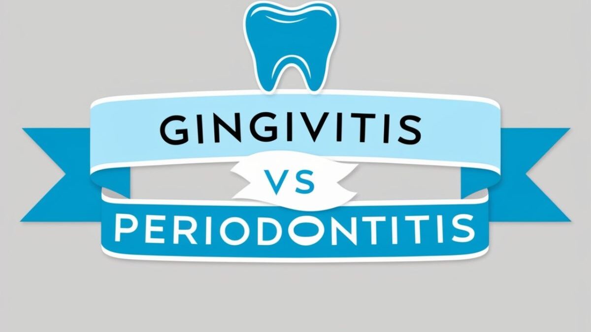Gingivitis vs Periodontitis