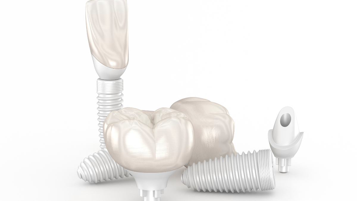 What Are Endosteal Implants?