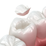 The Growing Demand for Mercury-Free and BPA-Free Dental Fillings