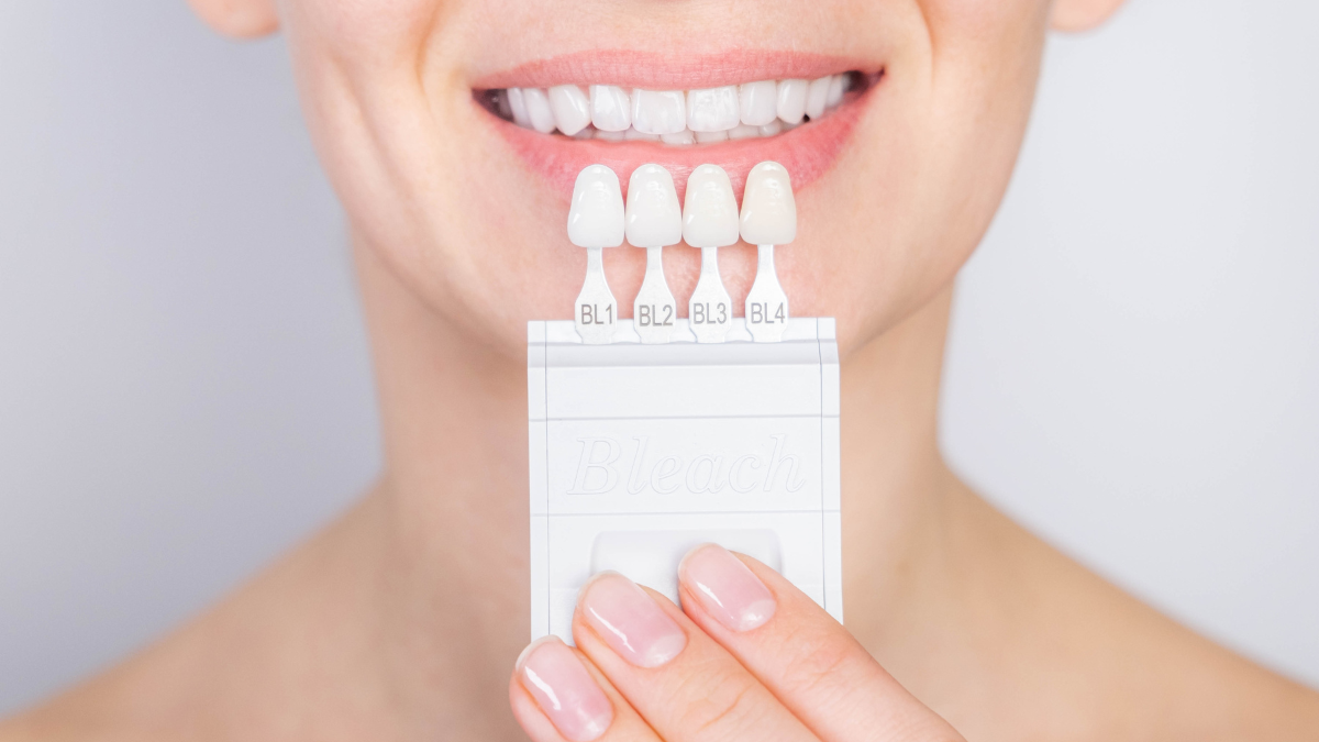 Smiling woman showcasing her perfect smile after porcelain veneers treatment at a dental clinic.