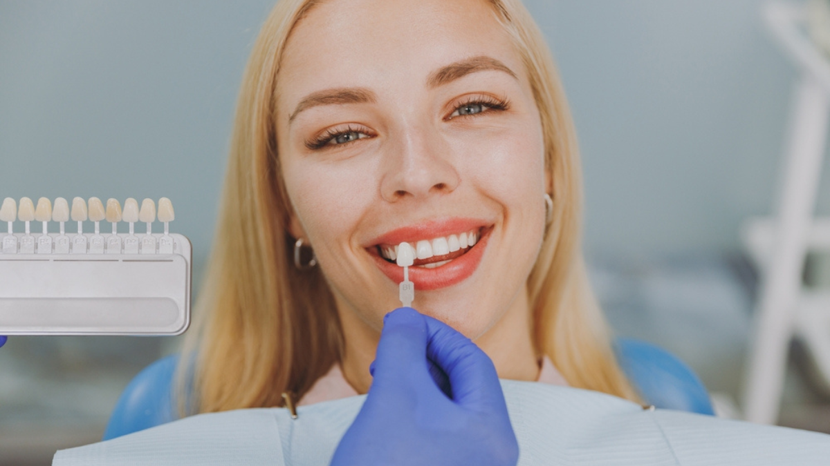 This is an image of smiling woman who is in the stage of shade choice through her porcelain veneers process.