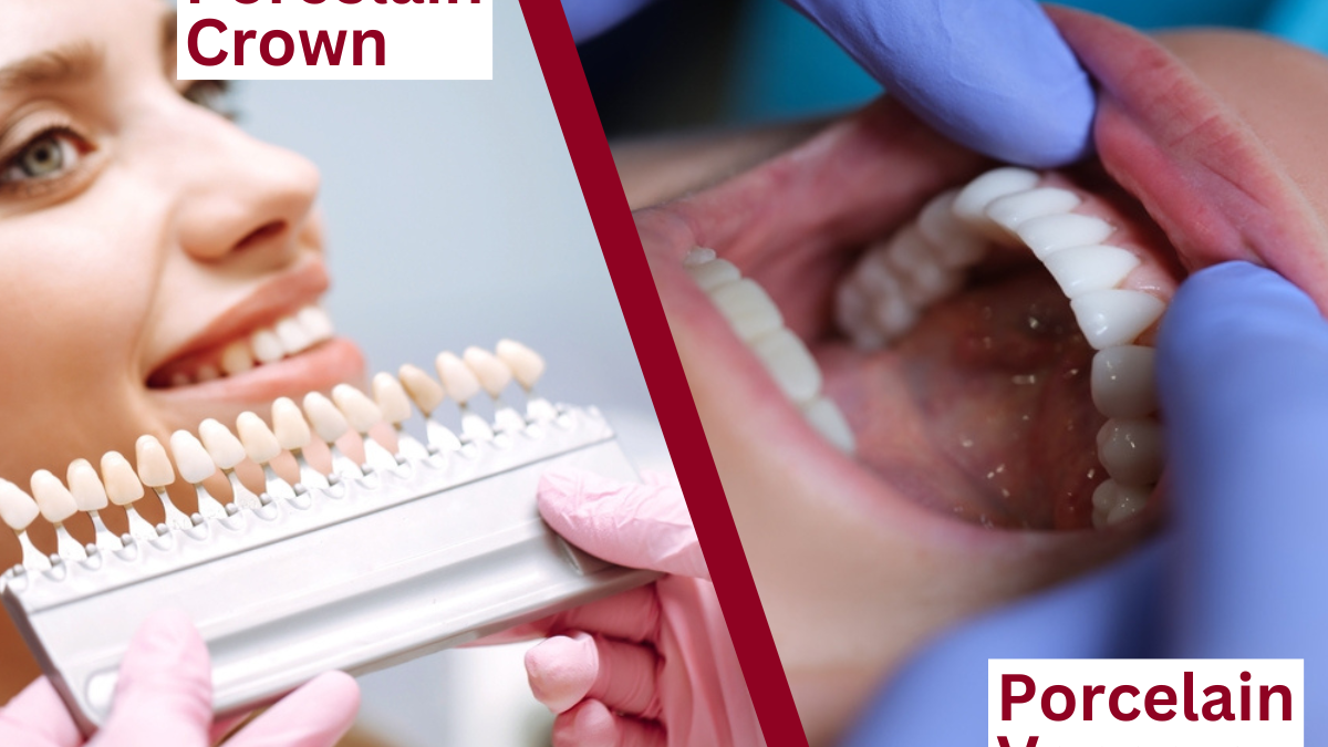 Porcelain Veneers vs Composite Resin: Which is Best for Your Smile?