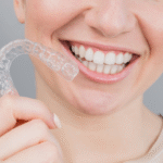 5 Bite Correction Treatment Options