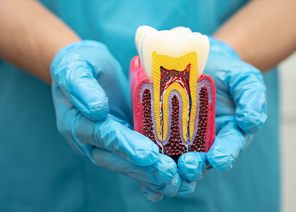 Zirconia Crown – Natural, Metal-Free, and Long-Lasting Smile Restoration
