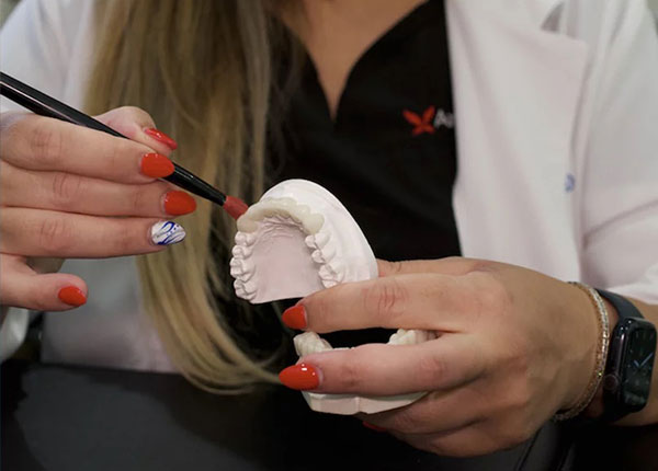 Zirconia Crown – Natural, Metal-Free, and Long-Lasting Smile Restoration