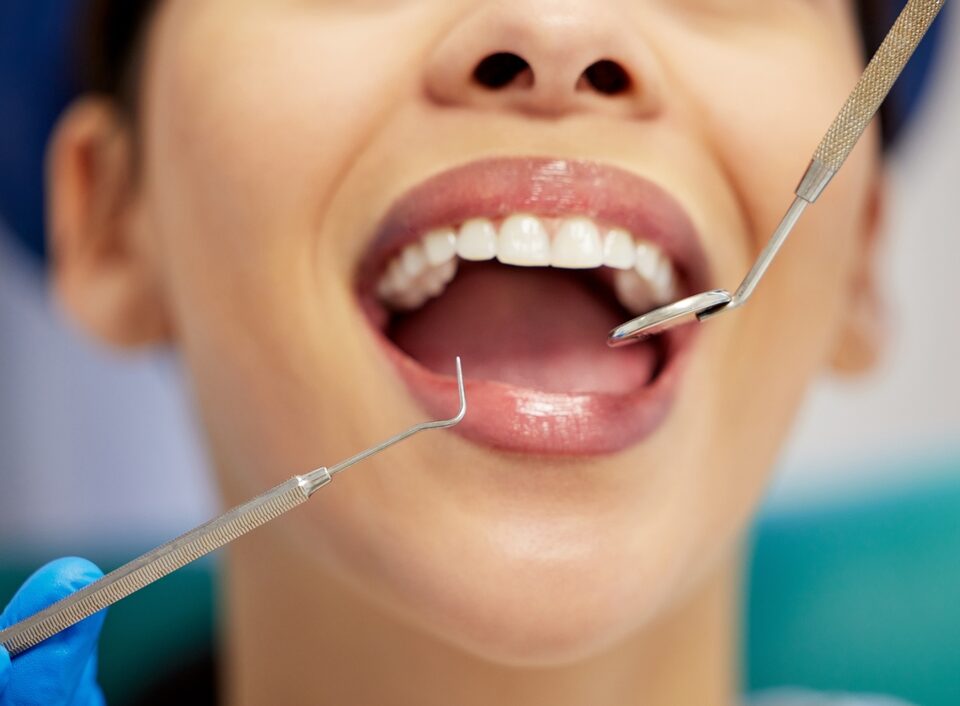 Cosmetic Dentistry Near Mission Viejo CA: Reshape Your Smile! 2 young women getting her teeth looked at by a dentist, close up shot