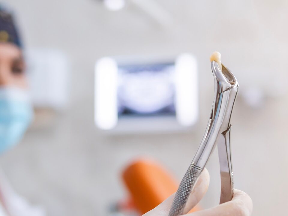 The Link Between Holistic Tooth Extraction and Chronic Illness Prevention 4 The Link Between Holistic Tooth Extraction and Chronic Illness Prevention