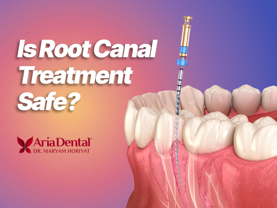 Is Root Canal Treatment Safe? A Holistic and Biological Perspective on Root Canal Treatment 4 Is Root Canal Treatment Safe? A Holistic and Biological Perspective on Root Canal Treatment
