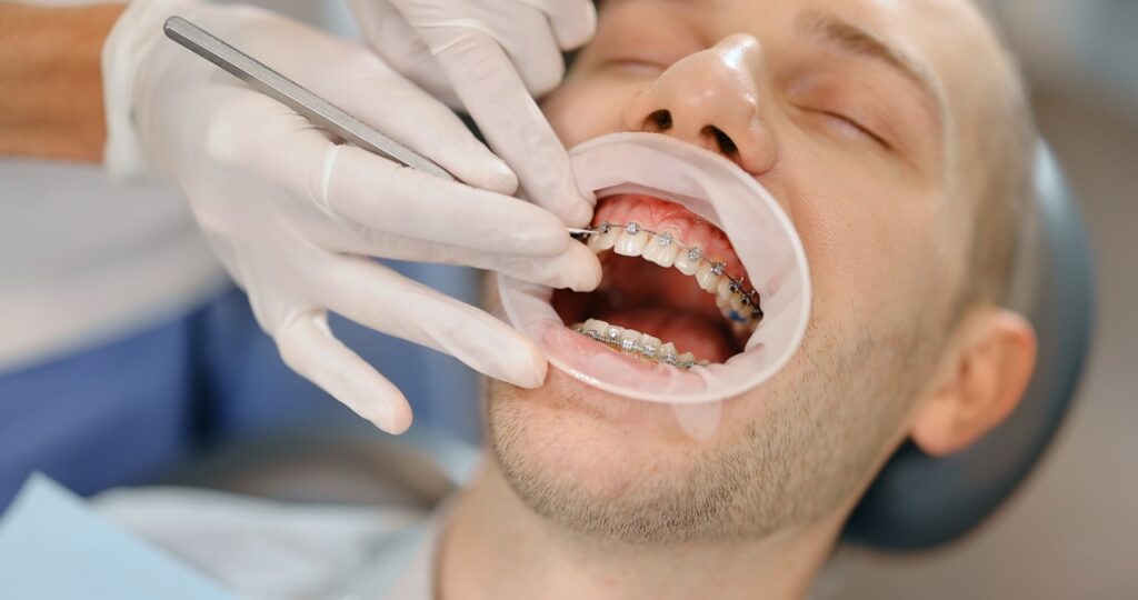 What Is Adult Orthodontics? A Holistic Dentist's Guide to Straighter Teeth at Any Age 2 doctor working on patient's orthodontics