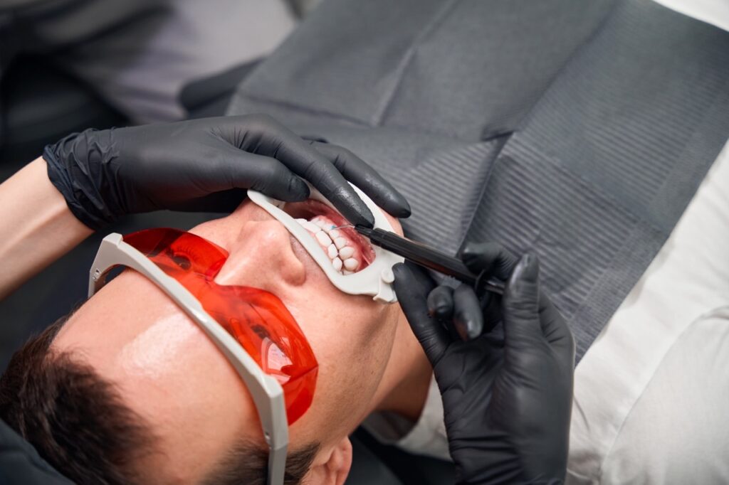 Teeth Whitening vs Veneers: Which Smile Upgrade Is Right for You? 2 Teeth Whitening vs Veneers: Which Smile Upgrade Is Right for You?