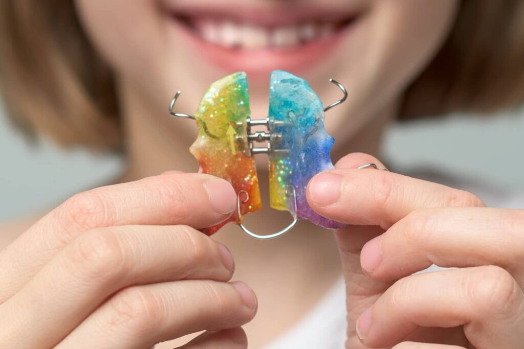 What Is an Expander for Braces? Signs You May Need One 1 What Is an Expander for Braces? Signs You May Need One