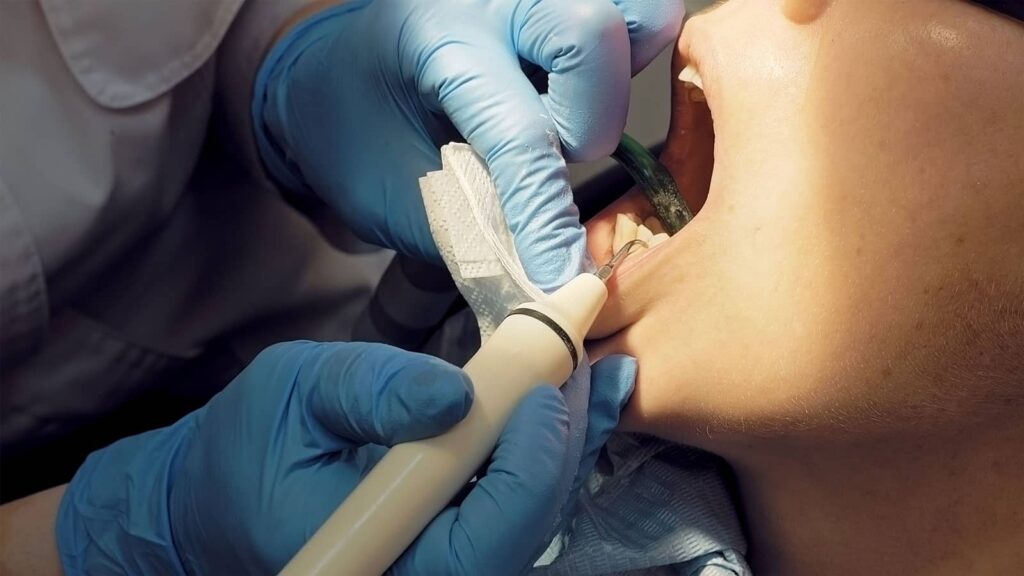 Can a Gum Graft Fix My Receding Gums? The Honest Answer from Aria Dental Care 4 Can a Gum Graft Fix My Receding Gums? The Honest Answer from Aria Dental Care