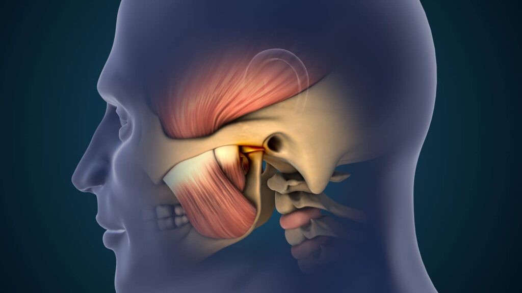How to Cure TMJ Permanently: Insights from Orange County’s Top Holistic Dental Office 1 How to Cure TMJ Permanently: Insights from Orange County’s Top Holistic Dental Office