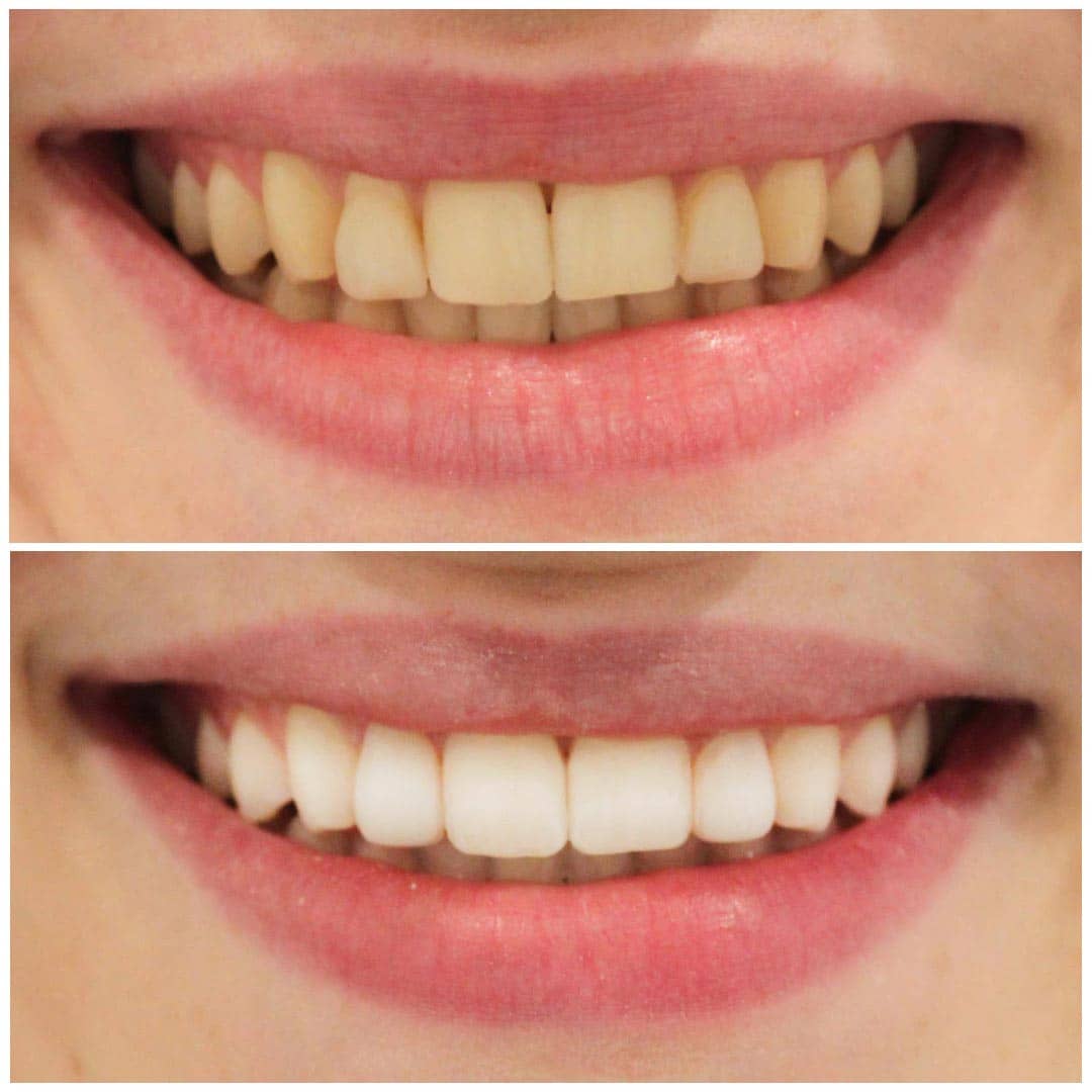 Cosmetic Dentistry vs. General Dentistry: What's the Difference? 1 Cosmetic Dentistry vs. General Dentistry: What's the Difference?
