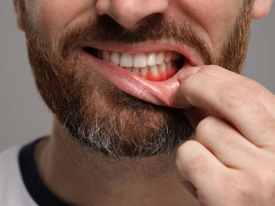 Can Gum Disease Kill You? Risks, Warning Signs, and Prevention