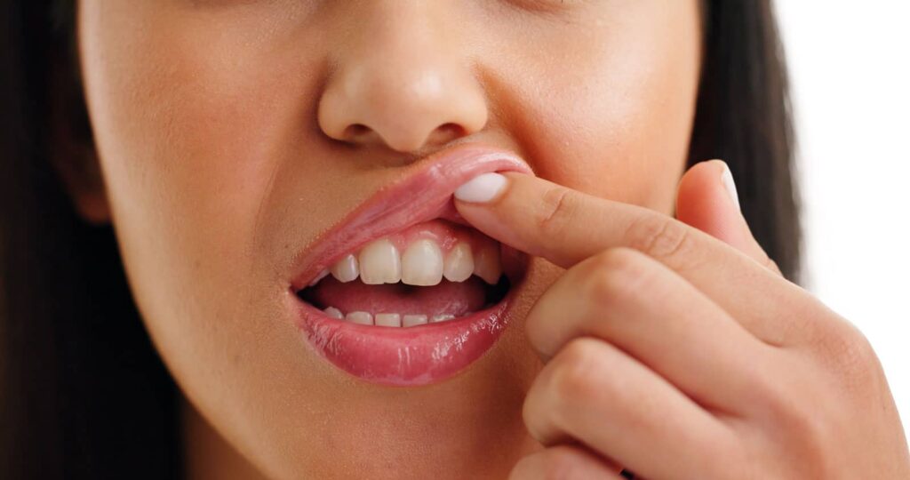 Can Gum Disease Kill You? Risks, Warning Signs, and Prevention 1 Can Gum Disease Kill You? Risks, Warning Signs, and Prevention