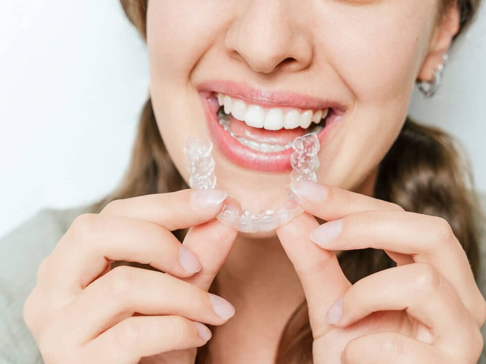 Common Orthodontic Appliances for Children, Teens, and Adults 4 Common Orthodontic Appliances for Children, Teens, and Adults