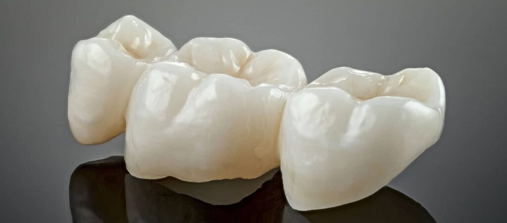 Cosmetic Dental Treatments: From Whitening to Veneers 3 Cosmetic Dental Treatments: From Whitening to Veneers