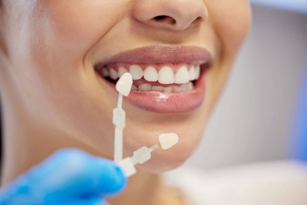 Can a Porcelain Crown Be Reshaped? A Biological Dentist's Approach to Adjustment Before Replacement 2 Can a Porcelain Crown Be Reshaped? A Biological Dentist's Approach to Adjustment Before Replacement
