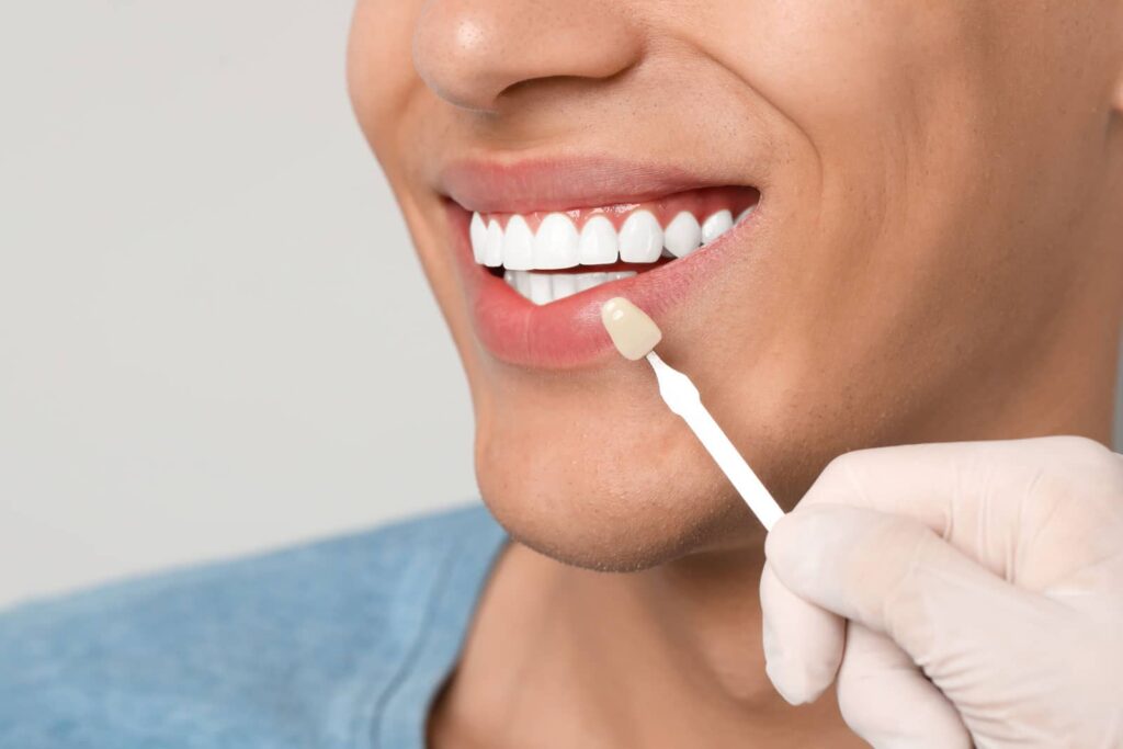 Can a Porcelain Crown Be Reshaped? A Biological Dentist's Approach to Adjustment Before Replacement 1 Can a Porcelain Crown Be Reshaped? A Biological Dentist's Approach to Adjustment Before Replacement