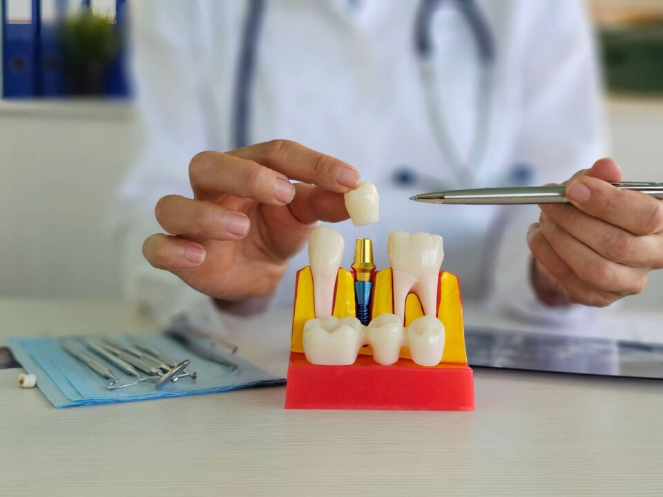 Ceramic Teeth Cap vs Metal Crown: Why More Patients Choose Metal-Free 4 Ceramic Teeth Cap vs Metal Crown: Why More Patients Choose Metal-Free