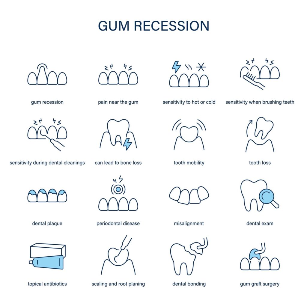 What Is Gingival Recession Surgery? A Plain-Language Guide 2 What Is Gingival Recession Surgery? A Plain-Language Guide