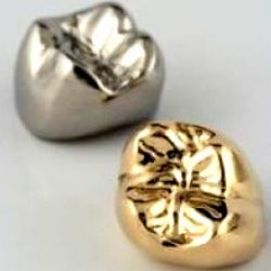 gold-alloy-dental-crowns-250x250