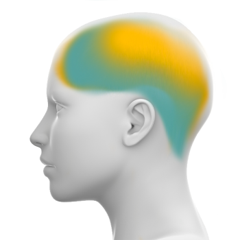 sleepapnea-central sleepapnea-central